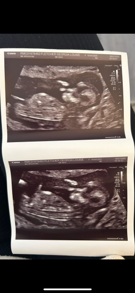 12 week 4 day scan