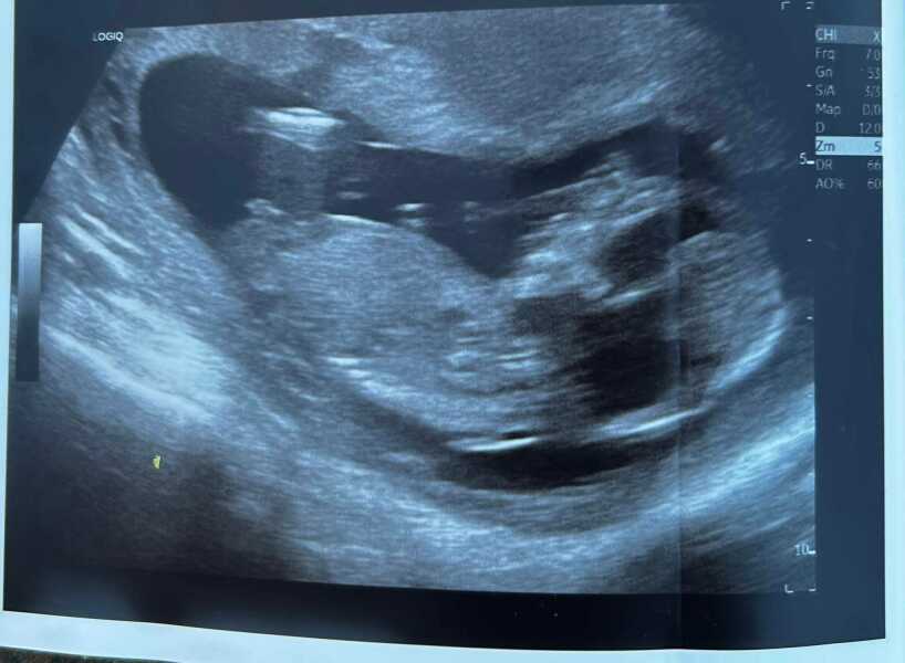 Help us guess the gender!