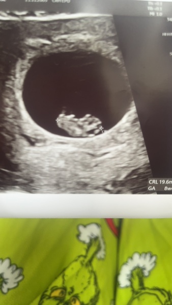 Gender guesses