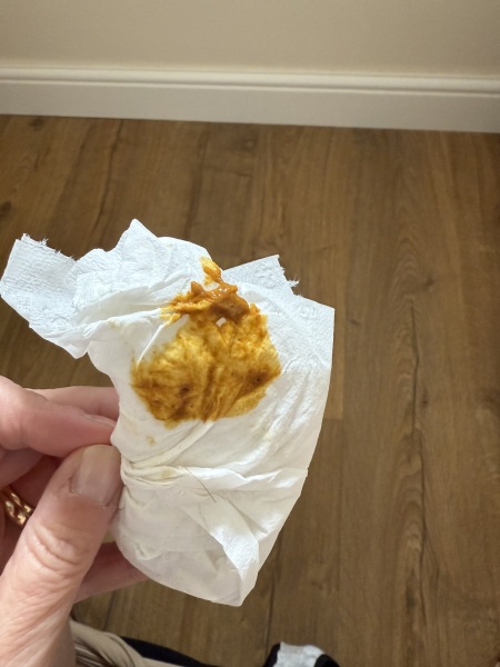 TMI - poop pic included. Is this IBS or BAM?