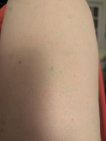 Have I tattooed my forehead? (Accidentally!)