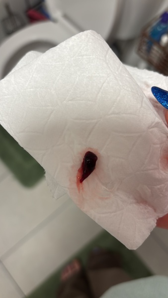 Is this a miscarriage?