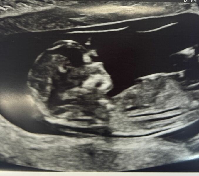 Due January 2026 - thread 2