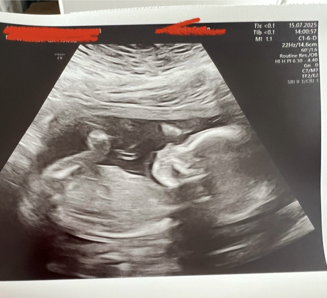 Gender guess!!