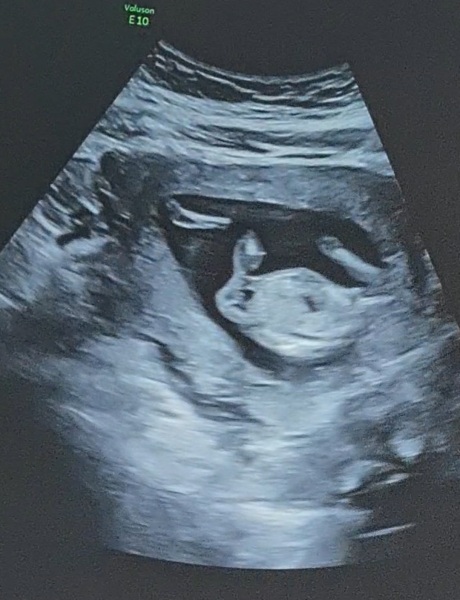 What do you see?