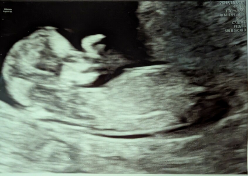 Boy or girl