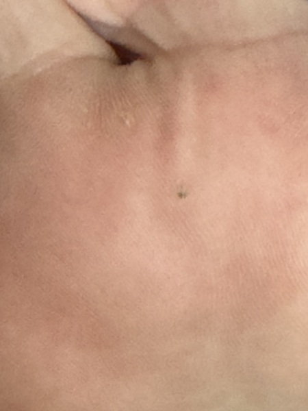 what is this on my foot?