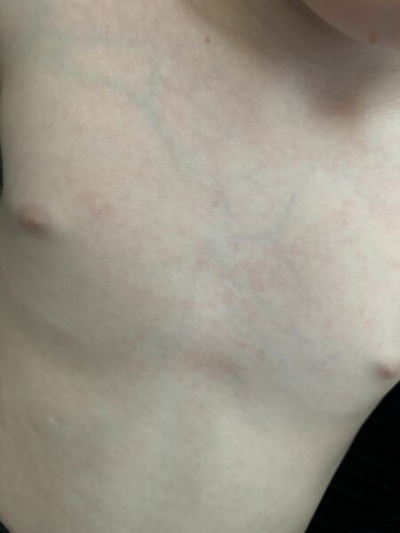 Is this heat rash or a reaction?