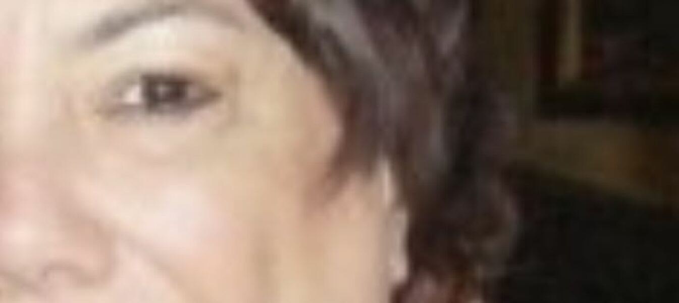Eye colour