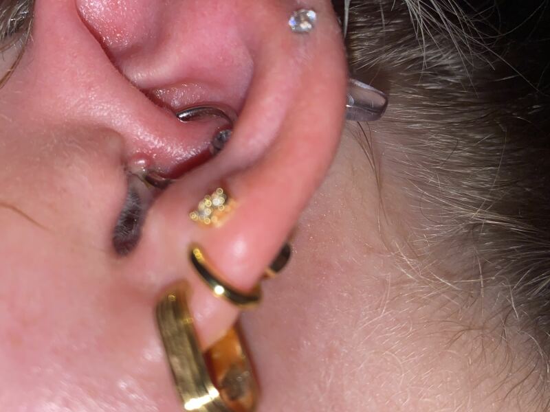 Piercing infection help!