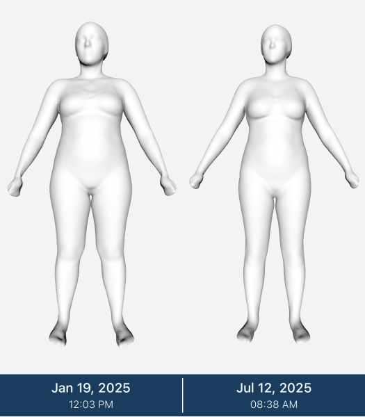 Mounjaro starters Nov ‘24 Thread 12 - The one where we pack all of the smaller size clothes into our holiday luggage 🥰