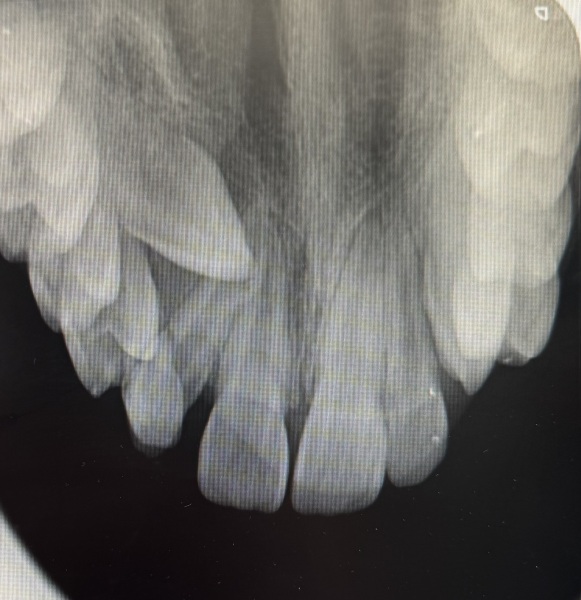 To sue the orthodontist?