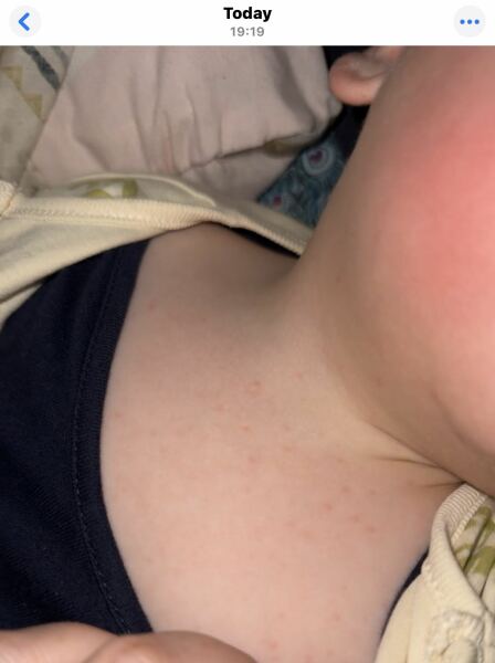 Does anyone know what this rash could be