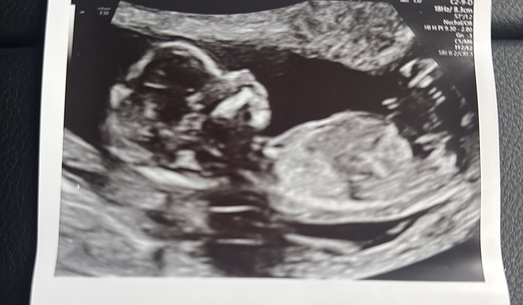 Any guesses for fun on my rainbow baby??!!!