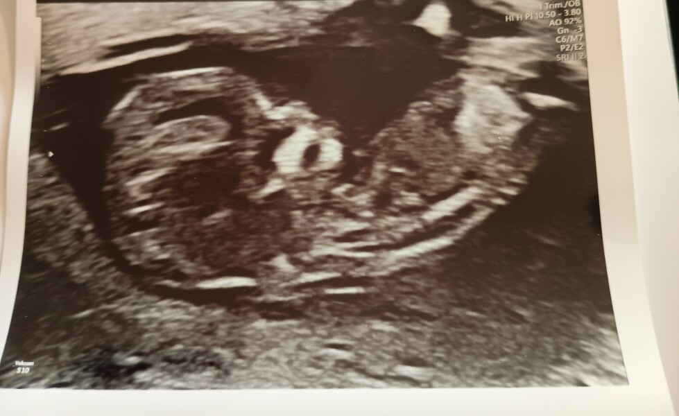 Due February 2026 - thread 2