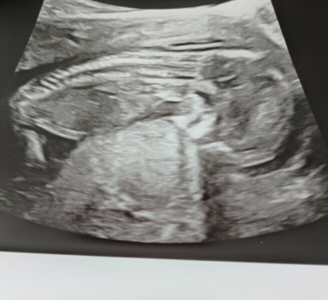 Any guesses! Boy or girl 💙🩷