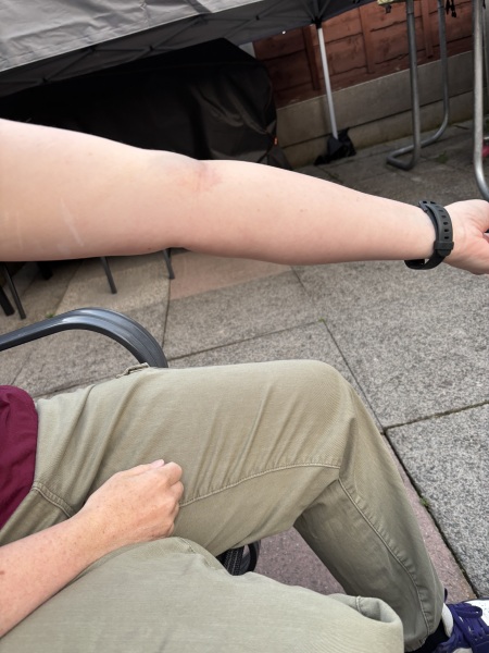 Blood test-is this normal (pic attached)