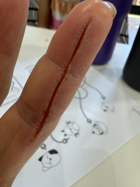 Do I need medical help?