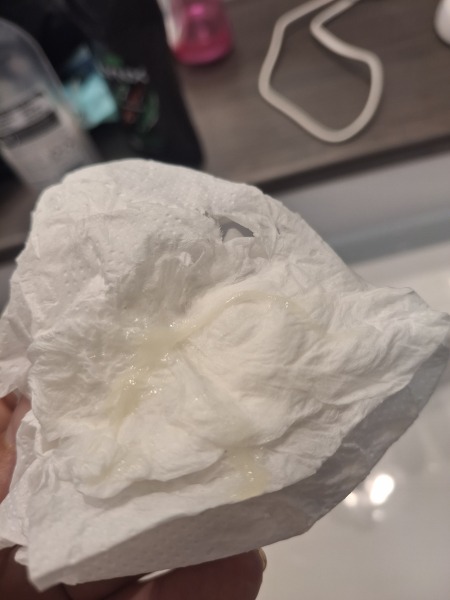 Discharge or mucus plug