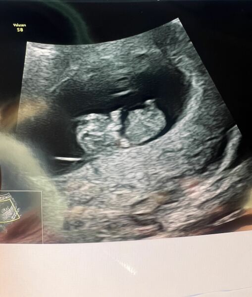 4w5d test still not dark solid