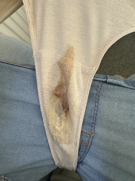 Mucus plug ?
