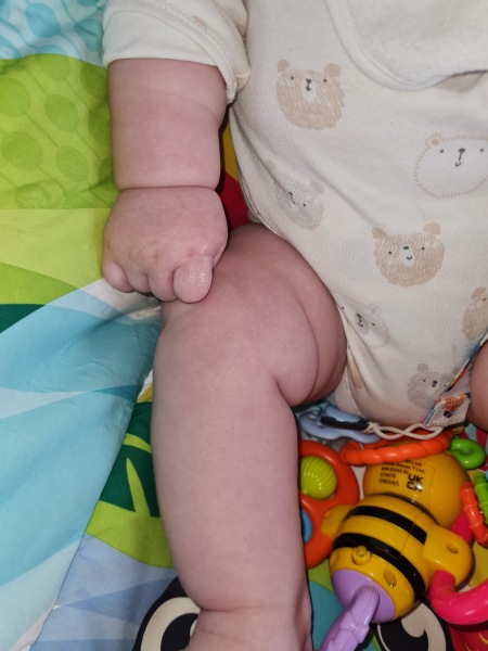 Baby breathing, subcostal retractions :(