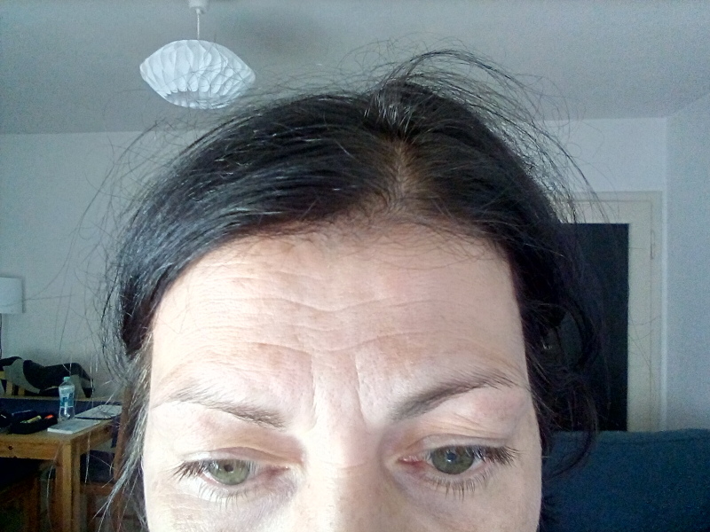 Tired eyes