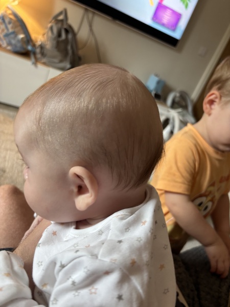 Does my baby have a flat head?