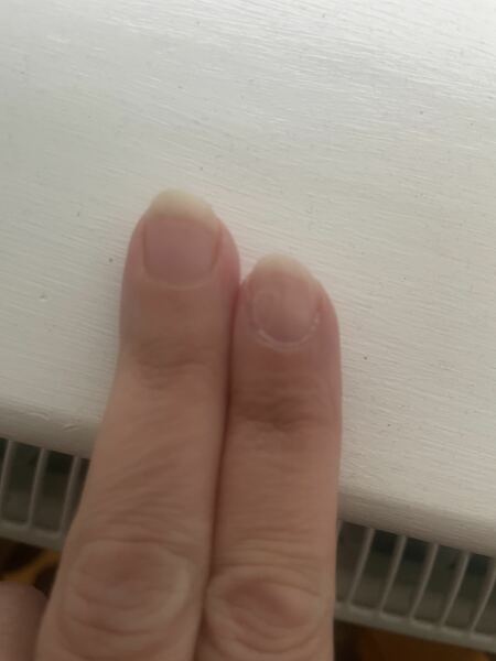 Pink nail varnish