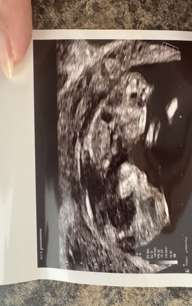 Gender guesses/nub theory?