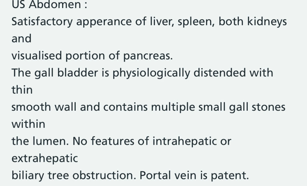 Gallstone stories?
