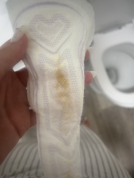 Could this be inplantion?