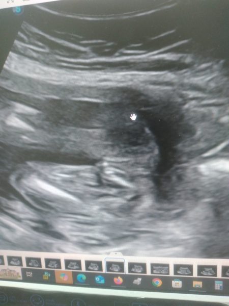 Potty shot! Boy or girl ?!