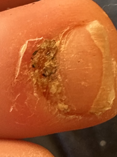 What is this?! (Toe)