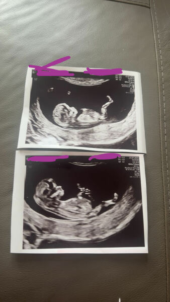 Boy  or girl?