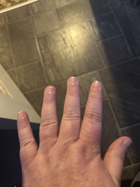 After biting my nails for 50 years…