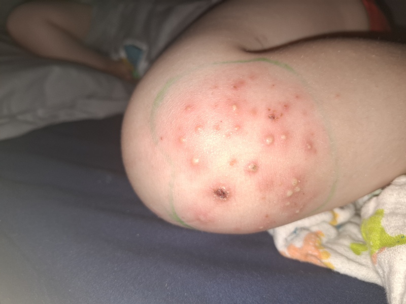 Is this a tonight emergency or can it wait to tomorrow?