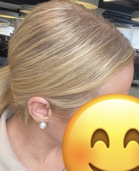 Are my highlights stripey?