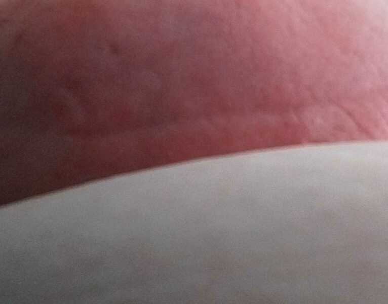 Likely breast cancer after ultrasound - thread 2