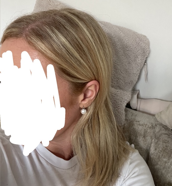 Are my highlights stripey?