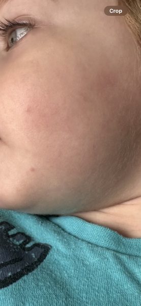 What are these spots?
