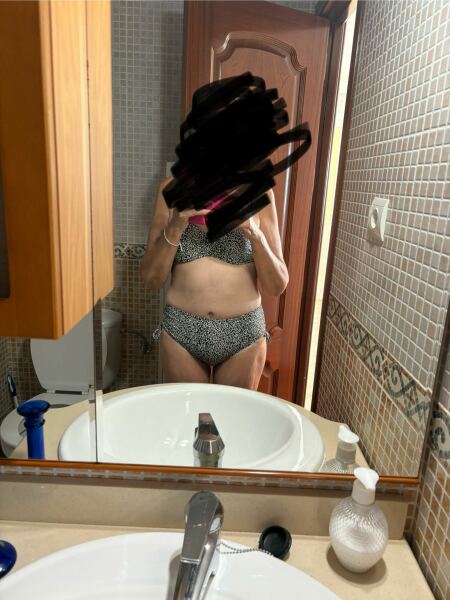 Anyone here had a tummy tuck after success on MJ ?