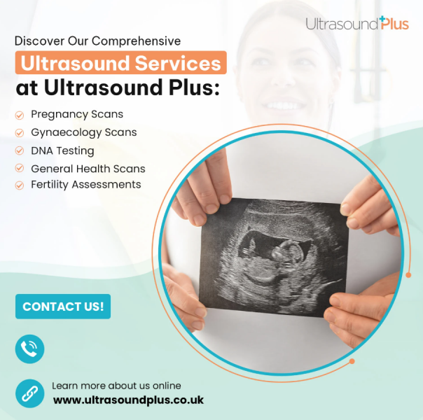 Private scans near Twickenham/Kingston/Richmond - recommendations?