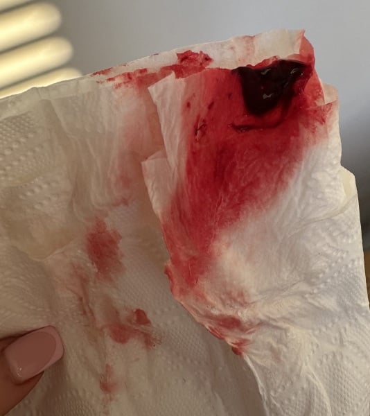 Early miscarriage or heavy period and clots