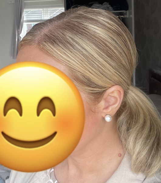 Are my highlights stripey?