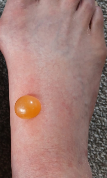 Do you want to see something *disgusting* on my leg?