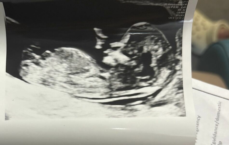 At least we avoided Christmas babies!