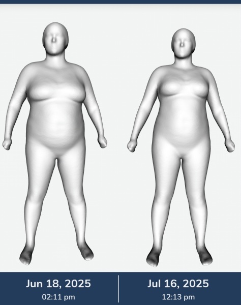 June 2025 Starters - Mounjaro (thread 4)