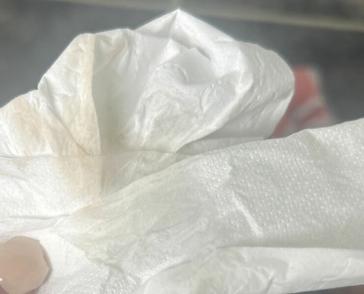 Need some advice on implantation!!!