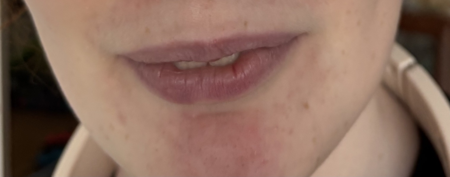 I think ive gone crazy over dds health i cant decide if im just imagining things!